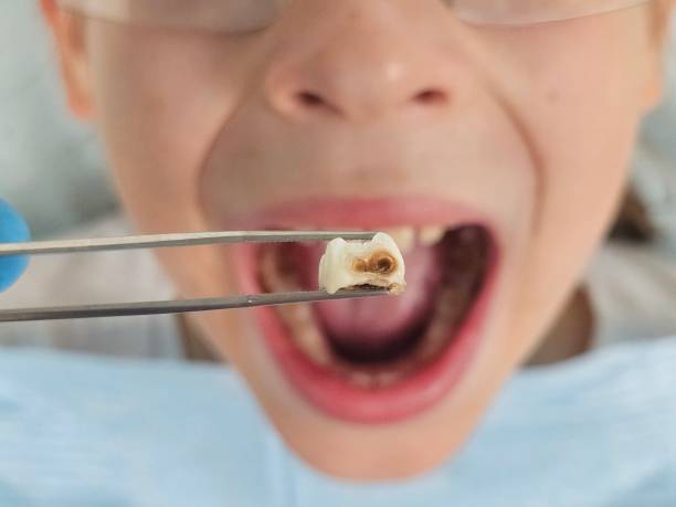 Best Orthodontic Emergency Dentist in Galveston, TX